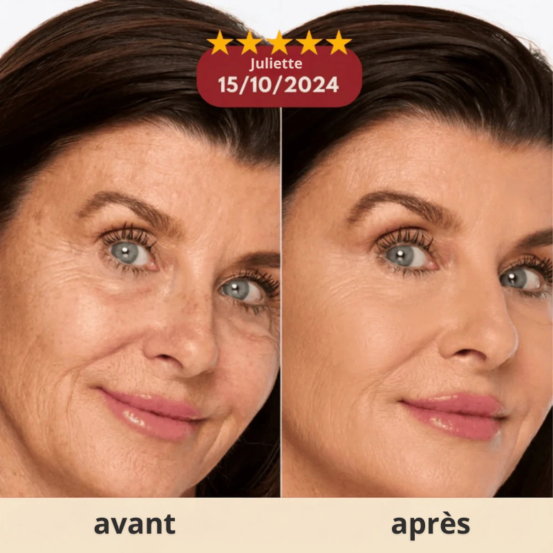 Stick au calcium anti ride