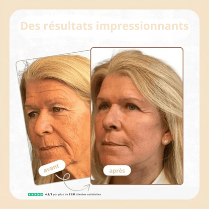 Stick au calcium anti ride